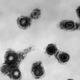 A electron microscope image of the chickenpox virus, varicella-zoster